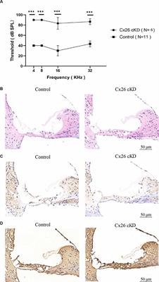 Failure Of Hearing Acquisition in Mice With Reduced Expression of Connexin 26 Correlates With the Abnormal Phasing of Apoptosis Relative to Autophagy and Defective ATP-Dependent Ca2+ Signaling in Kölliker’s Organ